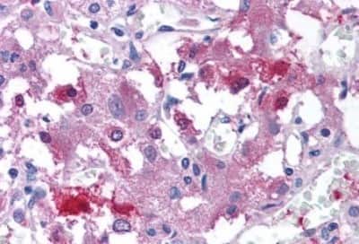 Immunohistochemistry-Paraffin: USP20 Antibody [NBP3-14514] - Immunohistochemistry of formalin-fixed, paraffin-embedded human adrenal medulla after heat-induced antigen retrieval.